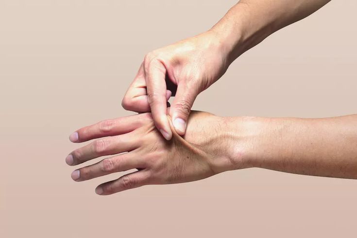 Pinch Test to check dehydration in the body